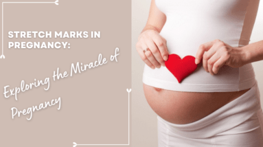 Stretch Marks in Pregnancy