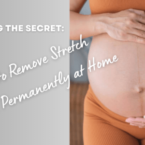 How to Remove Stretch Marks Permanently at Home