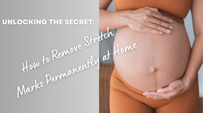 How to Remove Stretch Marks Permanently at Home